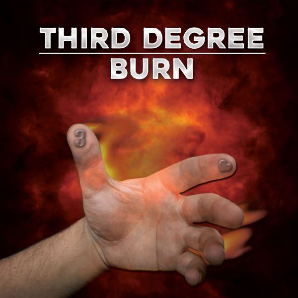 Third Degree Burn The Evolution